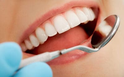 Root Canal for Infected Tooth: How It Saves Your Smile